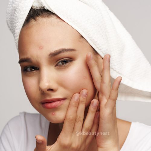women worried with her monsoon damaged skin